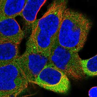 Immunocytochemistry/ Immunofluorescence: SAPS1 Antibody [NBP2-56076]