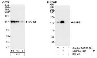 Western Blot: SAPS1 Antibody [NB100-41413]