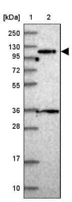 Western Blot: SAPS1 Antibody [NBP2-48803]