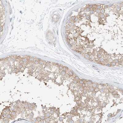 Immunohistochemistry-Paraffin: SAPS2 Antibody [NBP1-88014]