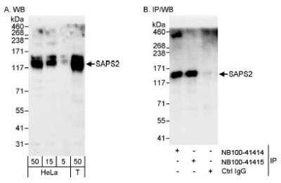 Western Blot: SAPS2 Antibody [NB100-41414]