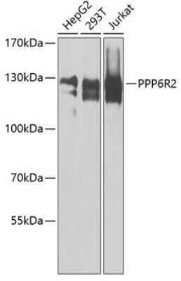 Western Blot: SAPS2 AntibodyBSA Free [NBP2-94580]