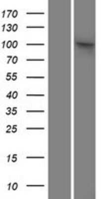 Western Blot: SAPS2 Overexpression Lysate [NBP2-10311]