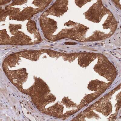 Immunohistochemistry-Paraffin: SAPS3 Antibody [NBP2-34048]