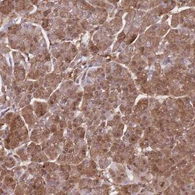 Immunohistochemistry-Paraffin: SAPS3 Antibody [NBP2-34048]