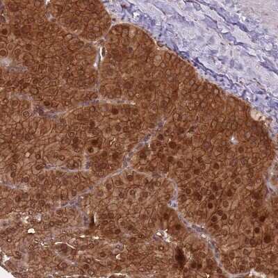 Immunohistochemistry-Paraffin: SAPS3 Antibody [NBP2-34048]