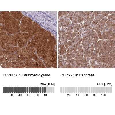 Immunohistochemistry-Paraffin: SAPS3 Antibody [NBP2-34048]