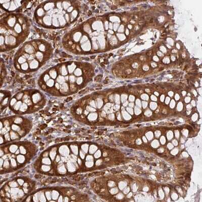 Immunohistochemistry-Paraffin: SAPS3 Antibody [NBP2-34049]