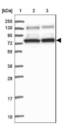 Western Blot: SAPS3 Antibody [NBP2-34049]