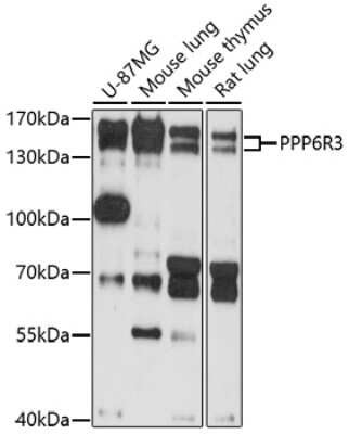 Western Blot: SAPS3 AntibodyAzide and BSA Free [NBP2-93106]