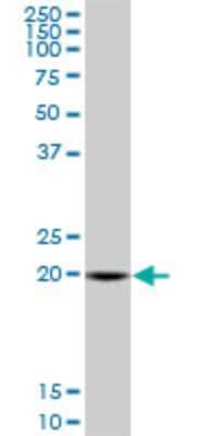 Western Blot: SAR1 Antibody (3G5) [H00056681-M01]