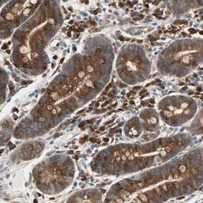 Immunohistochemistry-Paraffin: SAR1 Antibody [NBP1-80789]