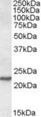 Western Blot: SAR1 Antibody [NBP1-02306]