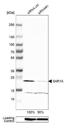 Western Blot: SAR1 Antibody [NBP1-80789]