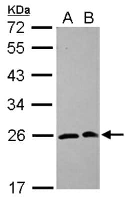 Western Blot: SAR1 Antibody [NBP2-20261]