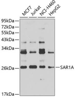 Western Blot: SAR1 AntibodyBSA Free [NBP2-93382]