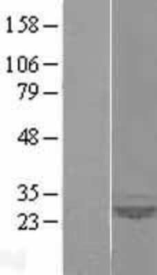 Western Blot: SAR1 Overexpression Lysate [NBL1-15691]