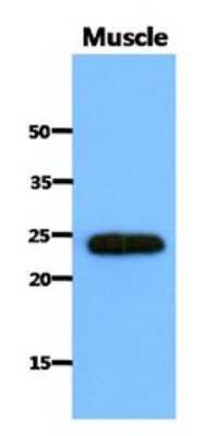 Western Blot: SAR1B Antibody (1C7)BSA Free [NBP2-22566]