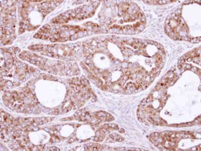 Immunohistochemistry-Paraffin: SAR1B Antibody [NBP1-32725]