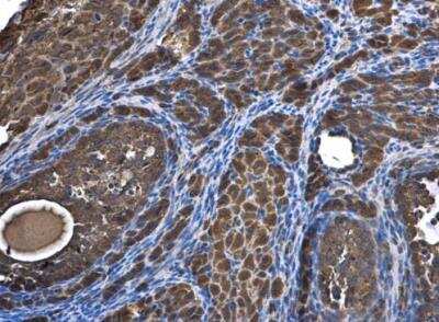Immunohistochemistry-Paraffin: SAR1B Antibody [NBP1-32725]