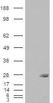 Western Blot: SAR1B Antibody [NBP1-06074]
