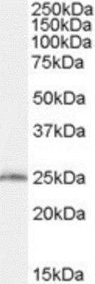 Western Blot: SAR1B Antibody [NBP1-06074]