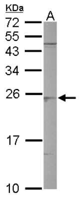 Western Blot: SAR1B Antibody [NBP1-32725]