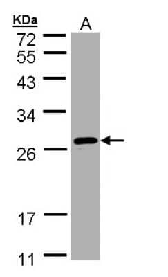 Western Blot: SAR1B Antibody [NBP1-32725]