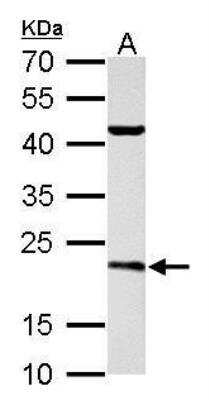 Western Blot: SAR1B Antibody [NBP1-32725]