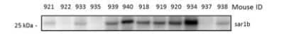 Western Blot: SAR1B Antibody [NBP1-32725]