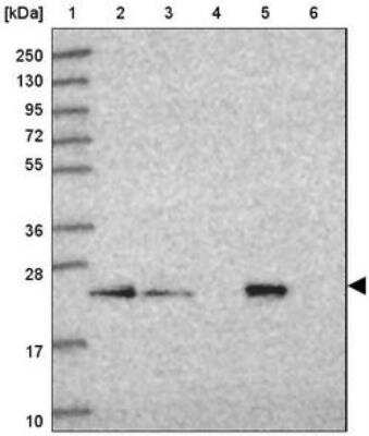 Western Blot: SAR1B Antibody [NBP2-33521]