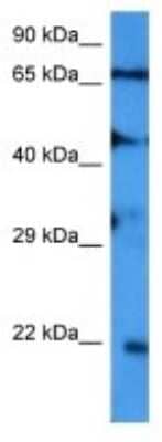 Western Blot: SAR1B Antibody [NBP3-10007]