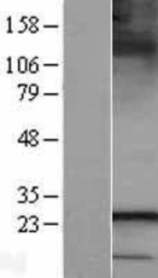 Western Blot: SAR1B Overexpression Lysate [NBL1-15692]