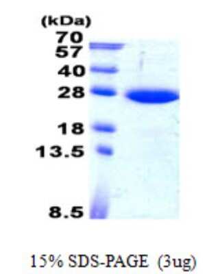 SDS-PAGE: Recombinant Human SAR1B His Protein [NBP2-23451]