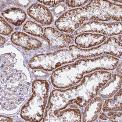 Immunohistochemistry: SARDH Antibody [NBP2-31705]