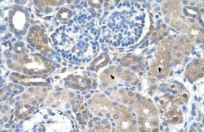 Immunohistochemistry-Paraffin: SARDH Antibody [NBP1-70769]