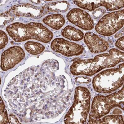 Immunohistochemistry-Paraffin: SARDH Antibody [NBP2-31668]