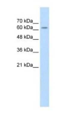 Western Blot: SARDH Antibody [NBP1-70769]