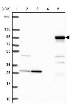 Western Blot: SARDH Antibody [NBP2-31668]