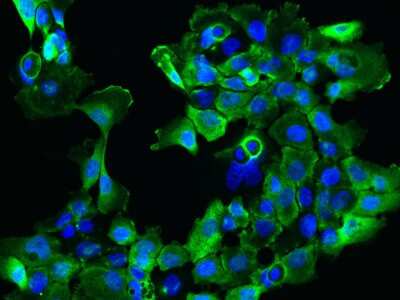 Immunocytochemistry/ Immunofluorescence: SARG Antibody [NBP2-97505]