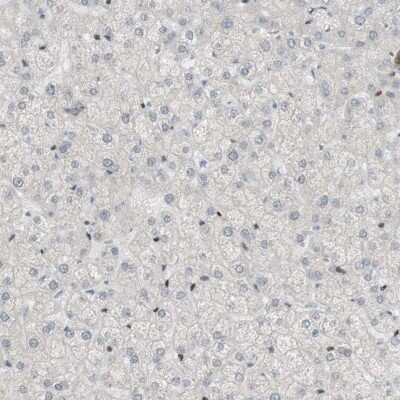 Immunohistochemistry-Paraffin: SARG Antibody [NBP1-81956]