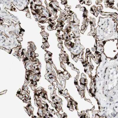 Immunohistochemistry-Paraffin: SARG Antibody [NBP1-81956]