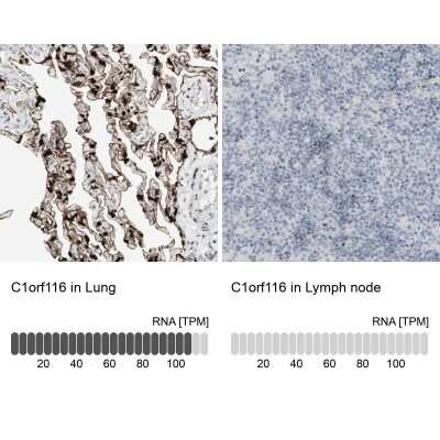 Immunohistochemistry-Paraffin: SARG Antibody [NBP1-81956]