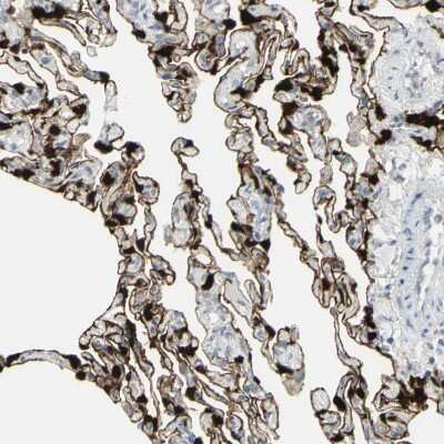 Immunohistochemistry-Paraffin: SARG Antibody [NBP1-83487]