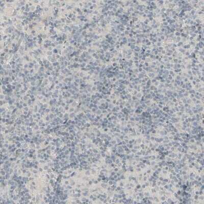 Immunohistochemistry-Paraffin: SARG Antibody [NBP1-83487]