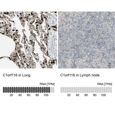 Immunohistochemistry-Paraffin: SARG Antibody [NBP1-83487]