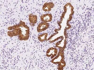 Immunohistochemistry-Paraffin: SARG Antibody [NBP2-97505]