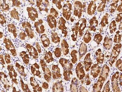 Immunohistochemistry-Paraffin: SARG Antibody [NBP2-97505]