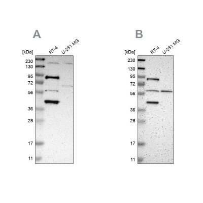 Western Blot: SARG Antibody [NBP1-81956]