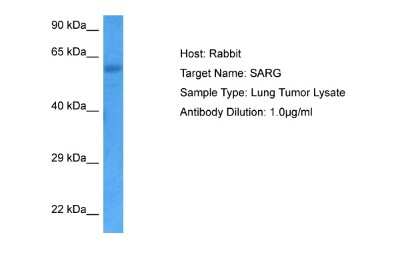 Western Blot: SARG Antibody [NBP2-88218]